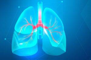 Câncer de Pulmão - Dr. Denyei Nakazato - Oncologista Clínico